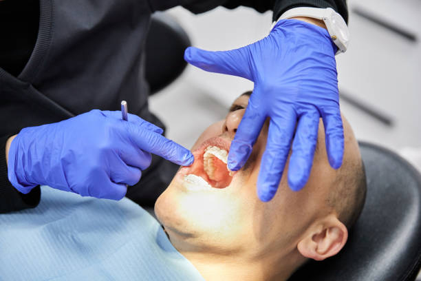 Best Emergency Tooth Extraction in Mills River, NC